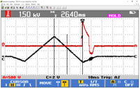 QRS 波と除細動波形