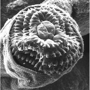 顎口虫(頭部)の電子顕微鏡写真