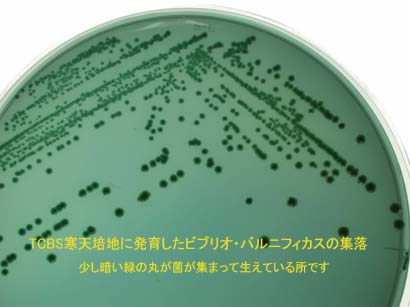 TCBS寒天培地に発育したビブリオ・バルニフィカスの集落の写真