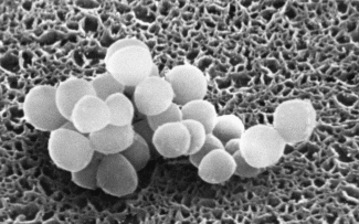 黄色ブドウ球菌の顕微鏡画像