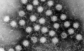 ノロウイルスの顕微鏡画像
